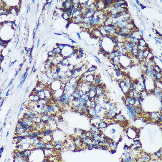 Anti-CDKL3 Antibody (CAB16689)