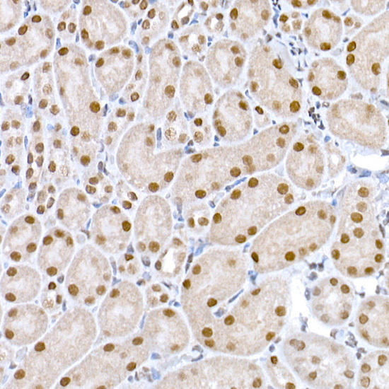 Immunohistochemistry of paraffin-embedded rat ovary using PLK1 Rabbit mAb at dilution of 1:100 (40x lens). Perform high pressure antigen retrieval with 10 mM citrate buffer pH 6. 0 before commencing with IHC staining protocol.