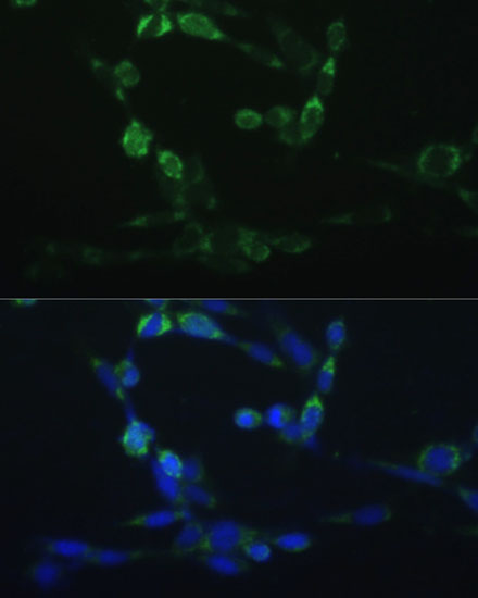 Anti-CYP24A1 Antibody (CAB1805)