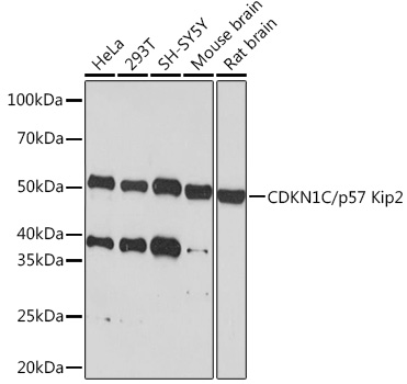 Anti-CDKN1C/p57 Kip2 Antibody (CAB6843)