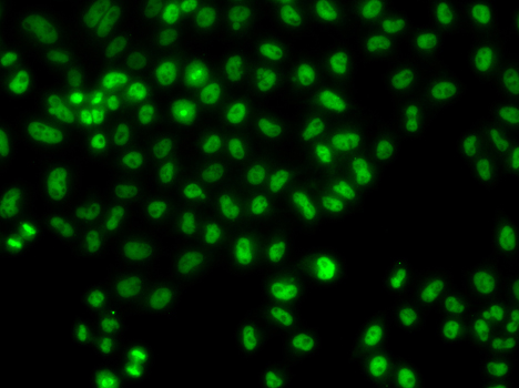 Anti-LHX8 Antibody (CAB13455)