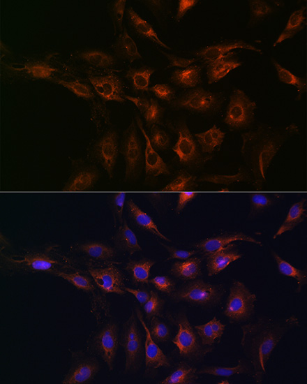 Anti-ABCA1 Antibody (CAB16337)