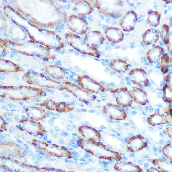 Anti-LONP1 Antibody (CAB4293)