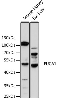 Anti-FUCA1 Antibody (CAB14533)