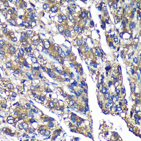 Anti-FBXO21 Antibody (CAB16107)