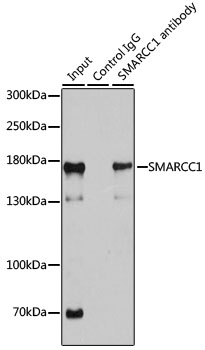 Anti-SMARCC1 Antibody [KO Validated] (CAB6128)