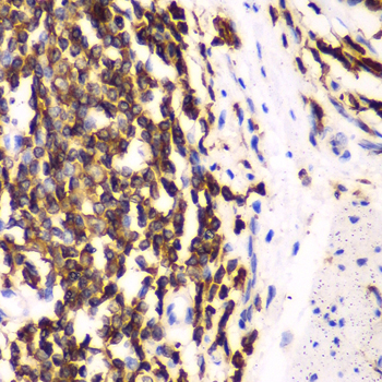 Anti-HCLS1 Antibody (CAB2165)