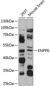 Anti-ENPP6 Antibody (CAB12290)