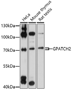 Anti-GPATCH2 Antibody (CAB17175)