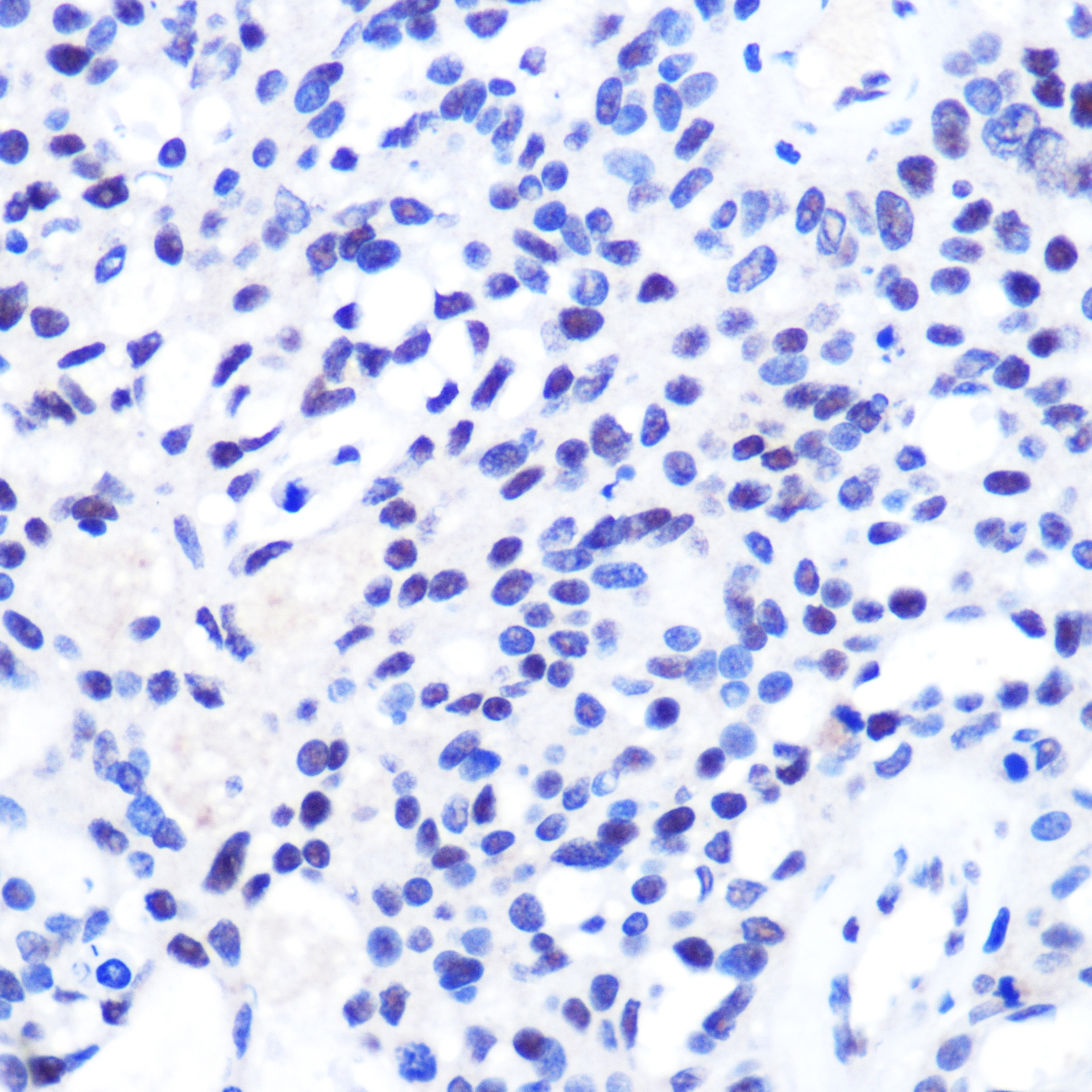 Anti-CHD4 Antibody (CAB11574)