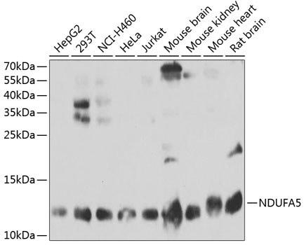 Anti-NDUFA5 Antibody (CAB3976)