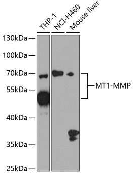 Anti-MT1-MMP Antibody (CAB2549)