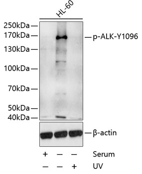 Anti-Phospho-ALK-Y1096 Antibody (CABP0503)