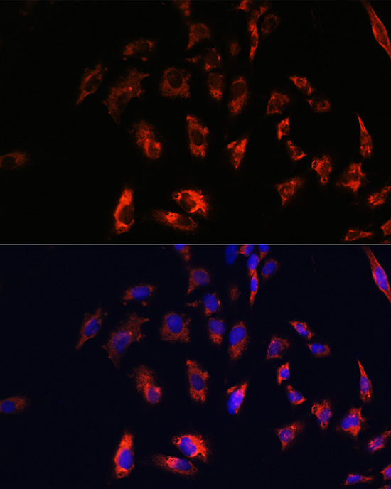 Anti-CD74 Antibody (CAB5667)