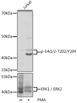 Anti-Phospho-Erk1/2-T202/Y204 Antibody (CABP1120)