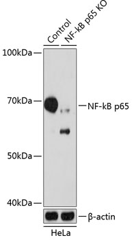 Anti-NF-kB p65 Antibody [KO Validated] (CAB19653)