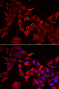 Anti-Caspase-14 Antibody (CAB6541)