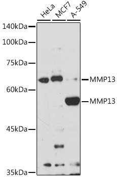 Anti-MMP13 Antibody [KO Validated] (CAB16920)