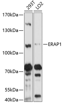 Anti-ERAP1 Antibody (CAB5248)