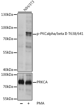 Anti-Phospho-PKCalpha/beta II-T638/641 Antibody (CABP0191)