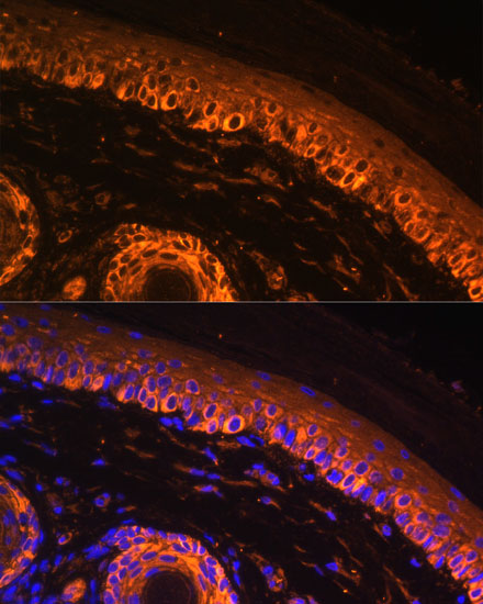 Anti-TYR Antibody (CAB1254)