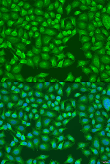 Anti-MERTK Antibody (CAB5443)