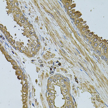 Anti-MYLIP Antibody (CAB6166)