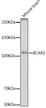 Anti-BCAR1 Antibody (CAB18270)