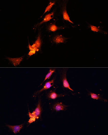 Anti-SUV39H1 Antibody (CAB3277)