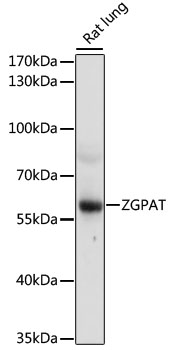 Anti-ZGPAT Antibody (CAB16583)