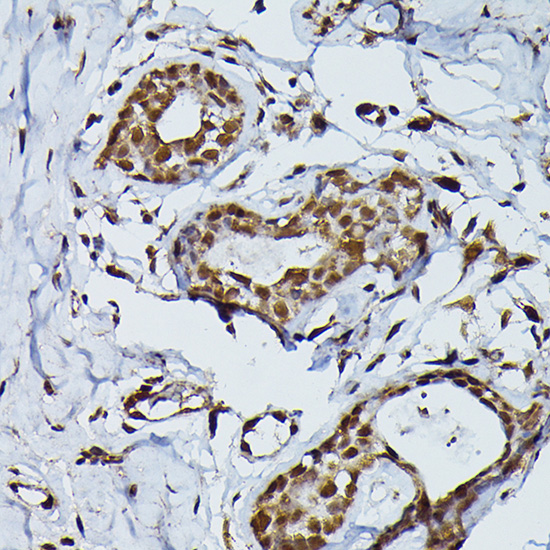 Anti-PRPF4 Antibody (CAB6052)