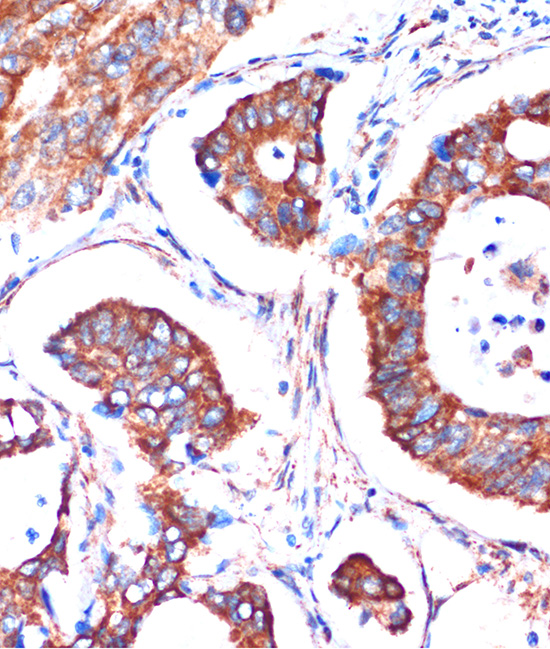 Anti-ME3 Antibody (CAB15787)