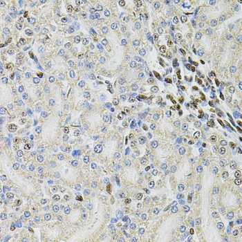 Anti-PSMC3 Antibody (CAB1986)