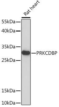 Anti-PRKCDBP Antibody (CAB17247)