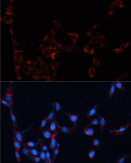 Anti-GPC4 Antibody (CAB12805)