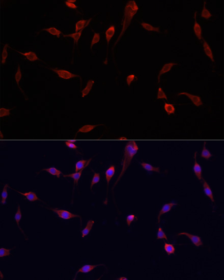 Anti-YAP1 Antibody (CAB11265)