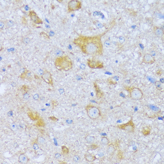 Anti-ACADSB Antibody (CAB15019)