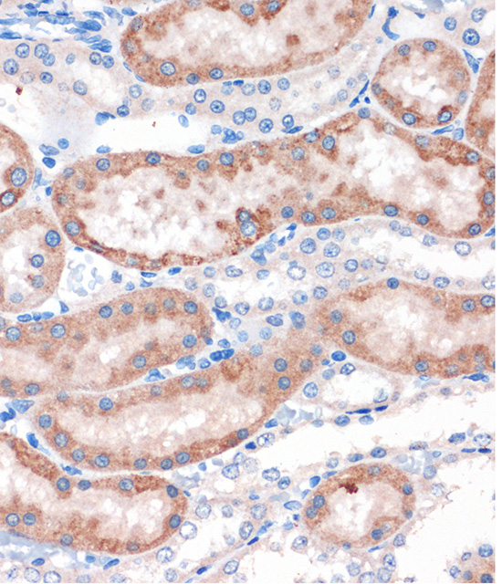 Anti-CHDH Antibody (CAB16545)