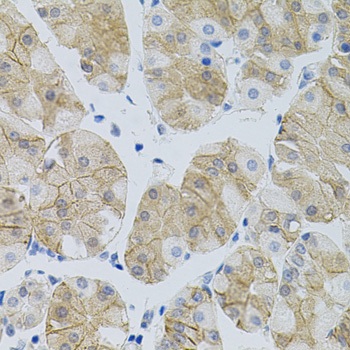 Anti-SLC6A1 Antibody (CAB7730)