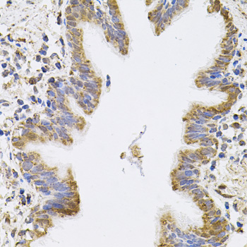 Anti-SPR Antibody (CAB7928)