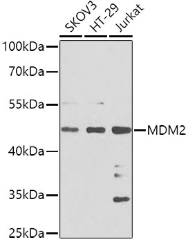 Anti-MDM2 Antibody (CAB0345)