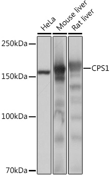 Anti-CPS1 Antibody (CAB4214)