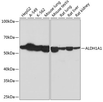 Anti-ALDH1A1 Antibody