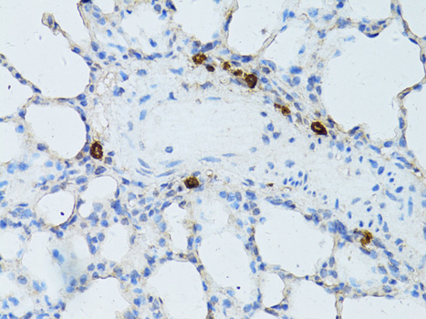 Anti-TEFM Polyclonal Antibody (CAB8511)