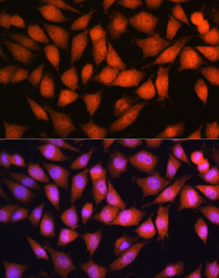 Anti-OTUB1 Antibody (CAB11656)