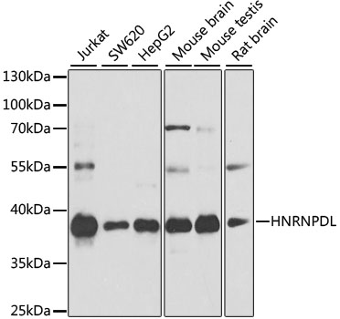 Anti-HNRNPDL Antibody (CAB10721)