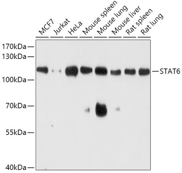 Anti-STAT6 Antibody (CAB0755)