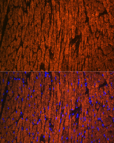 Anti-MYL2 Antibody (CAB14188)