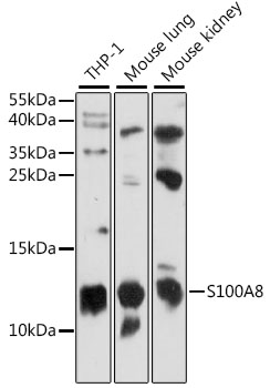 Anti-S100A8 Antibody (CAB15315)