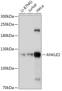 Anti-ANKLE2 Antibody (CAB17654)